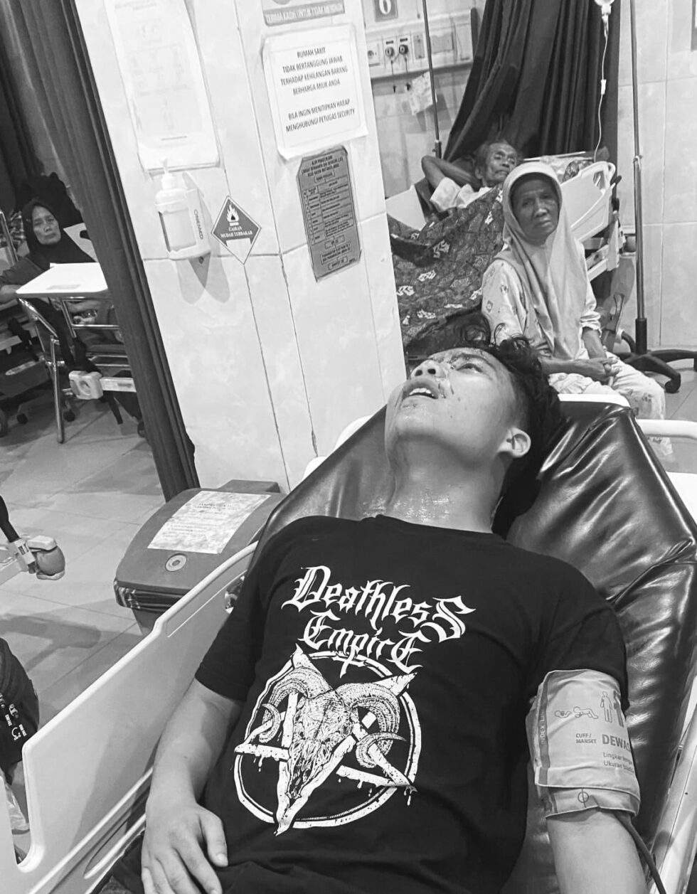 Pesan Wanita Lewat Aplikasi, Pria Ini Dikeroyok di Hotel Kawasan Pasar