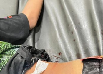 Duel Brutal Dua Remaja, Celurit Panjang Nancap di Tubuh Korban