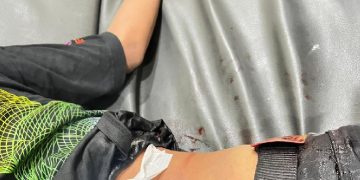 Duel Brutal Dua Remaja, Celurit Panjang Nancap di Tubuh Korban