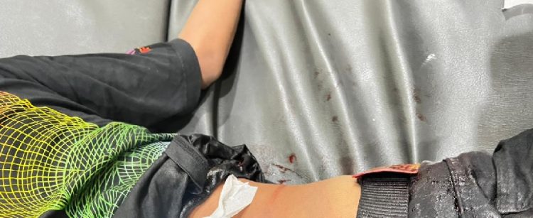 Duel Brutal Dua Remaja, Celurit Panjang Nancap di Tubuh Korban