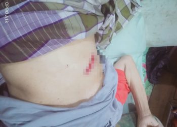 Luka Operasi Terbuka, Warga Alam Barajo Ini Menahan Sakit karena Tak Punya Biaya Berobat