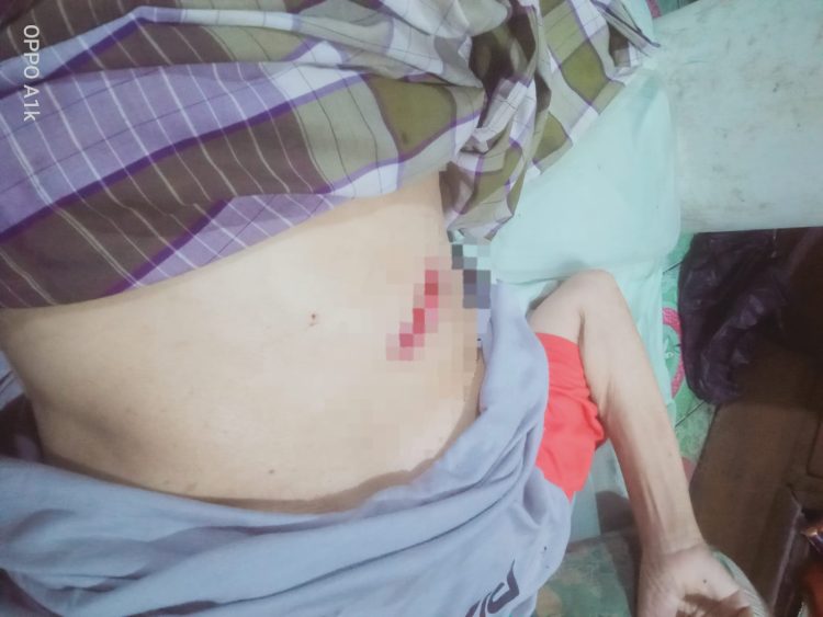 Luka Operasi Terbuka, Warga Alam Barajo Ini Menahan Sakit karena Tak Punya Biaya Berobat