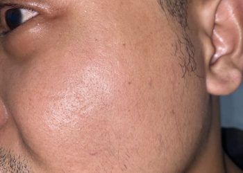 Akibat Cemburu Pemuda di Jambi Jadi Korban Penganiayaan, Pelaku Diduga Sempat Rampas HP